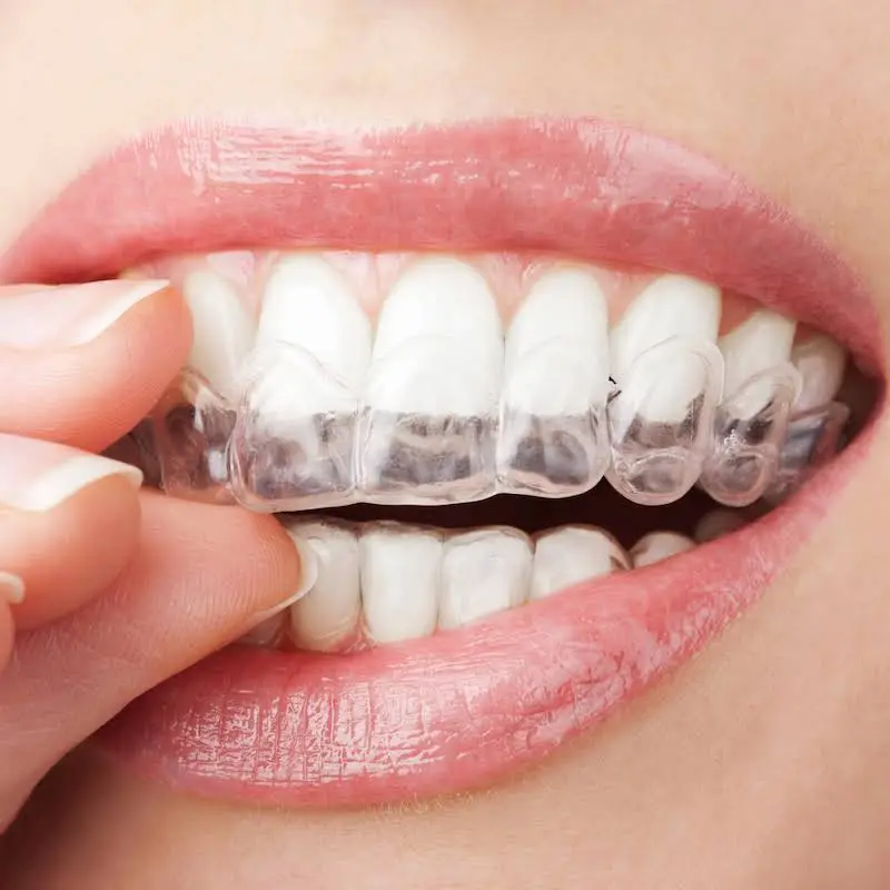 Burkhardt Pecora Bloomberg Orthodontics
