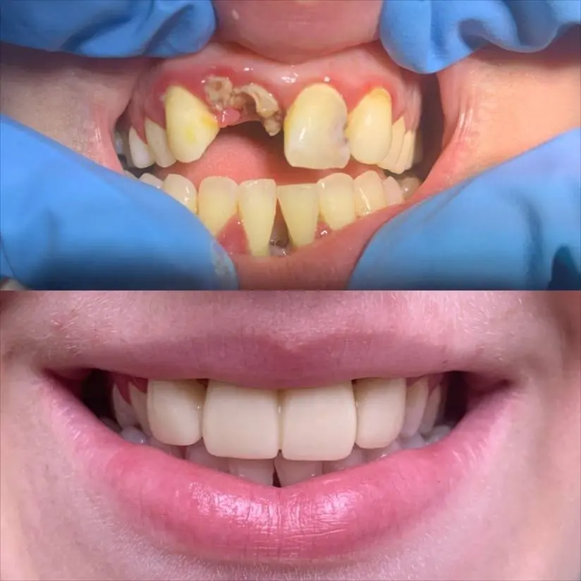 Axcel Dental