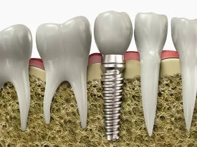Redwood Dental Davison