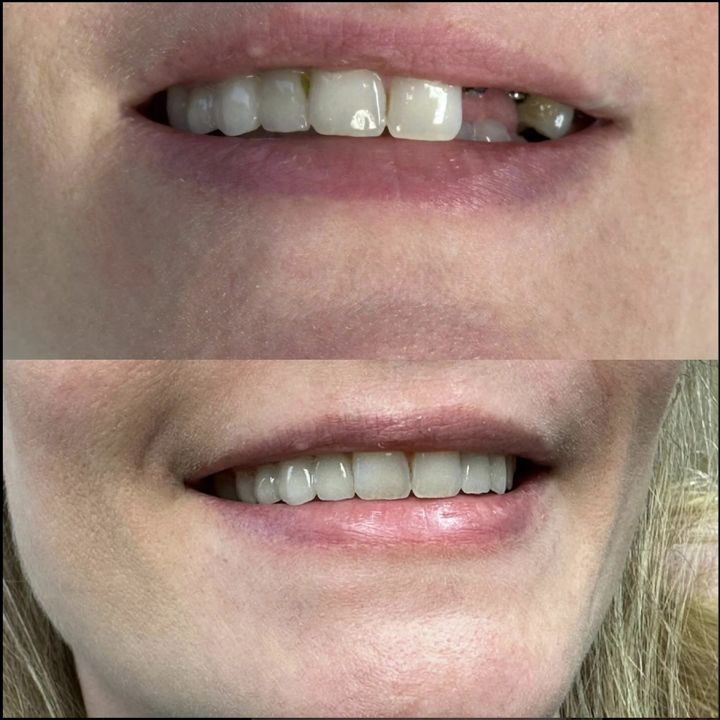 Smile Fresh Dental