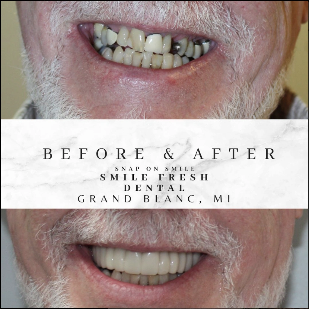 Smile Fresh Dental