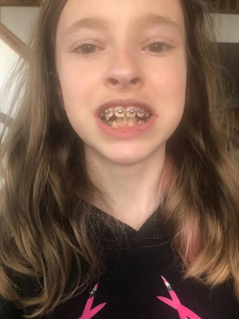 Resler Orthodontics - Caro