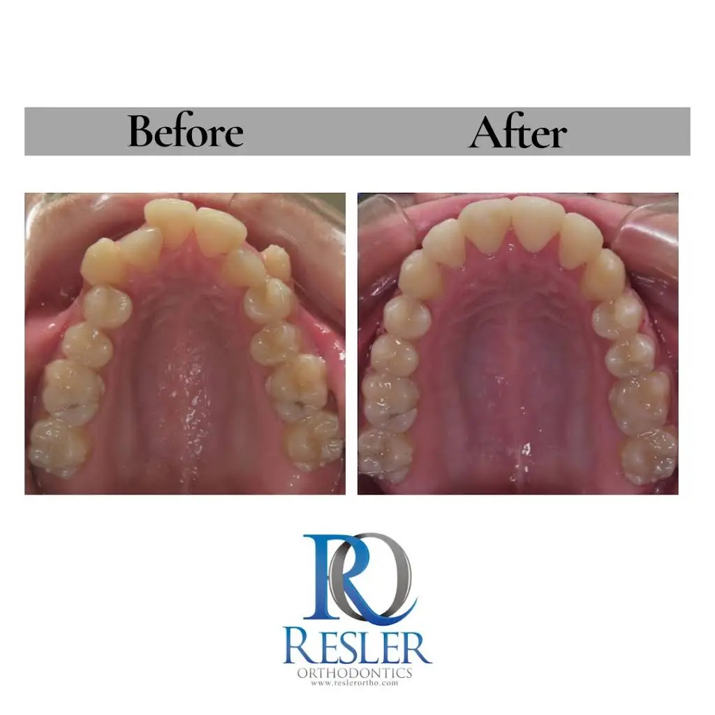 Resler Orthodontics - Caro