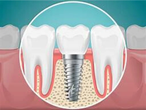 Bandy Dental