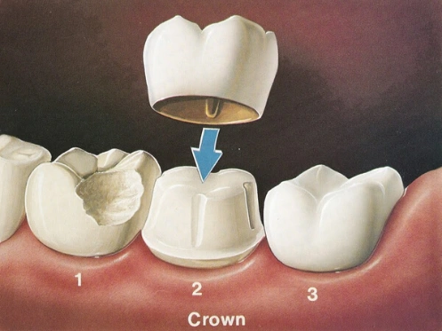 Bandy Dental