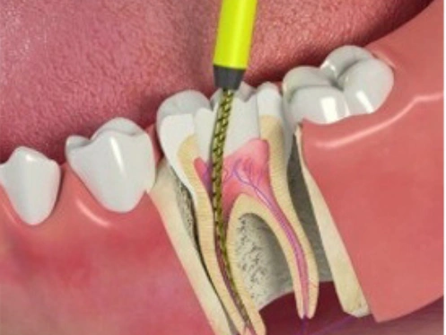 Bandy Dental