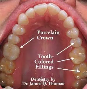 James D. Thomas, DDS, PC
