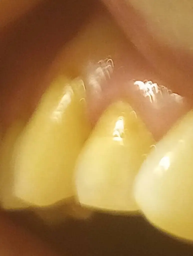 Dental Dreams