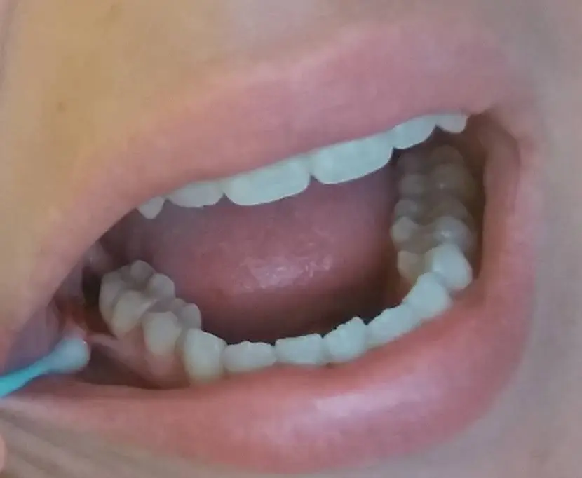 Dental Dreams