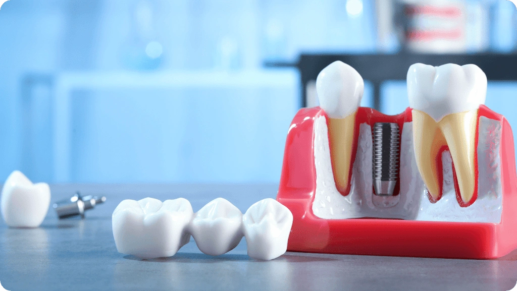Main Street Dental Clarkston