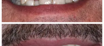Clarkston Dental Care