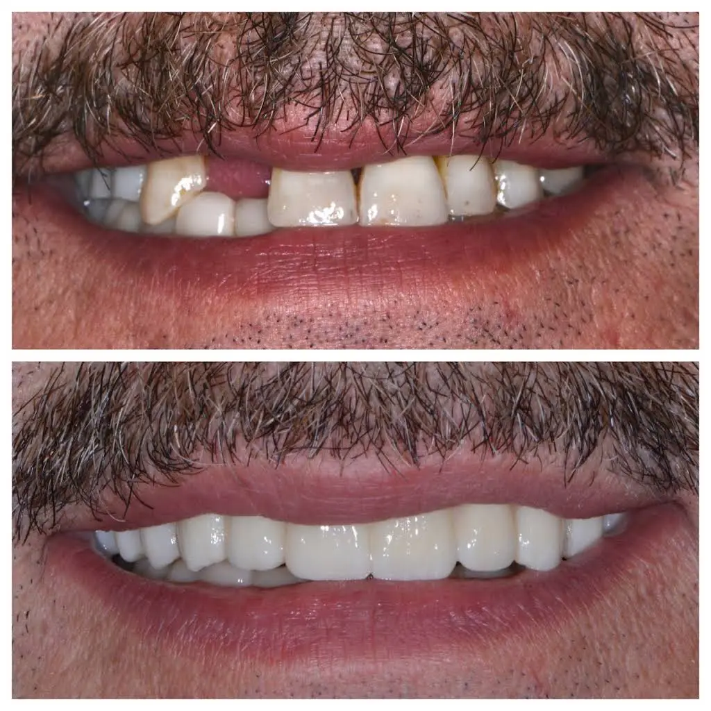 Clarkston Dental Care