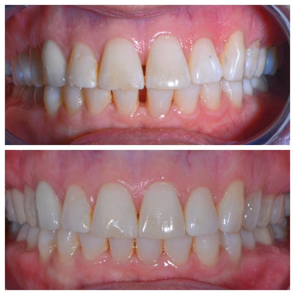 Clarkston Dental Care