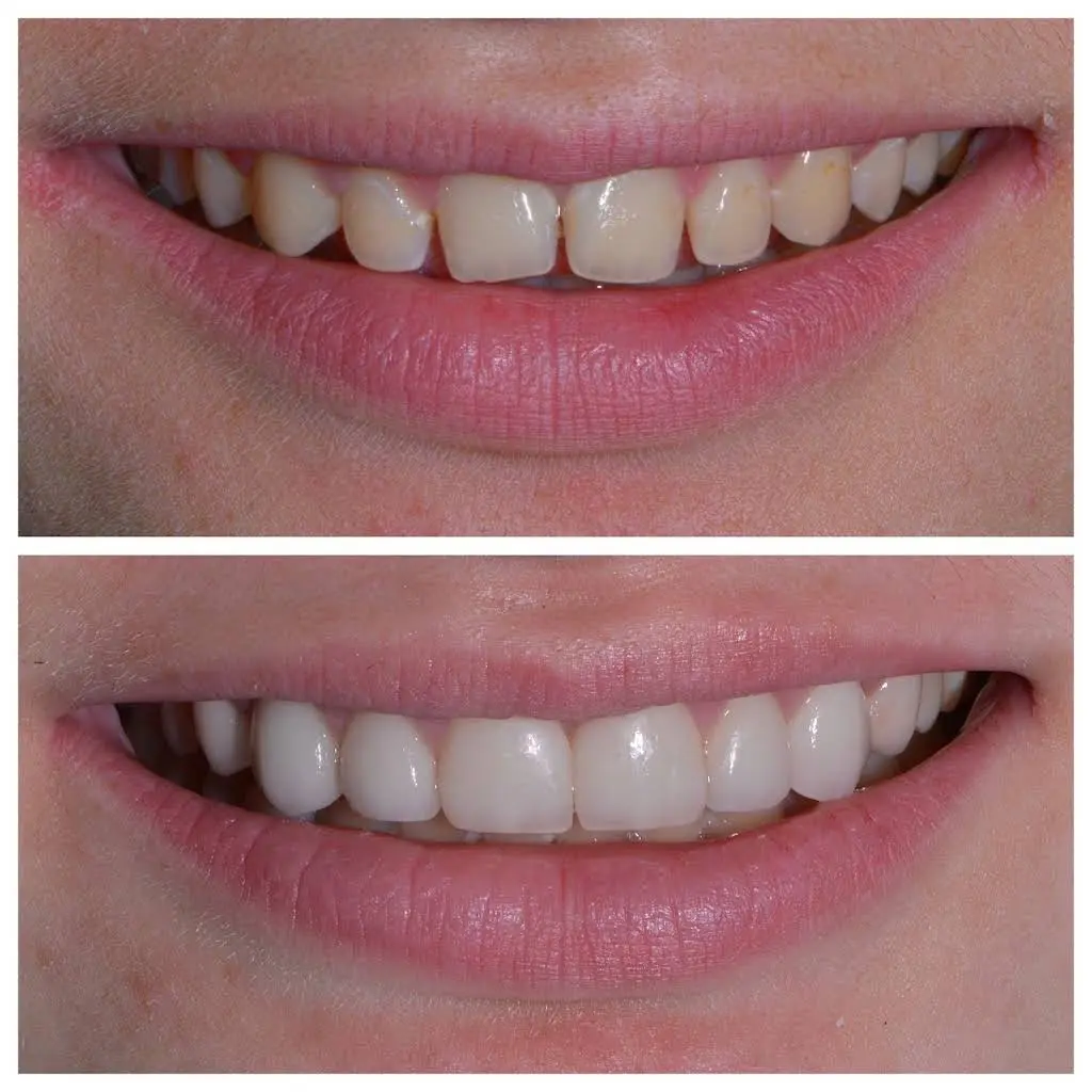 Clarkston Dental Care