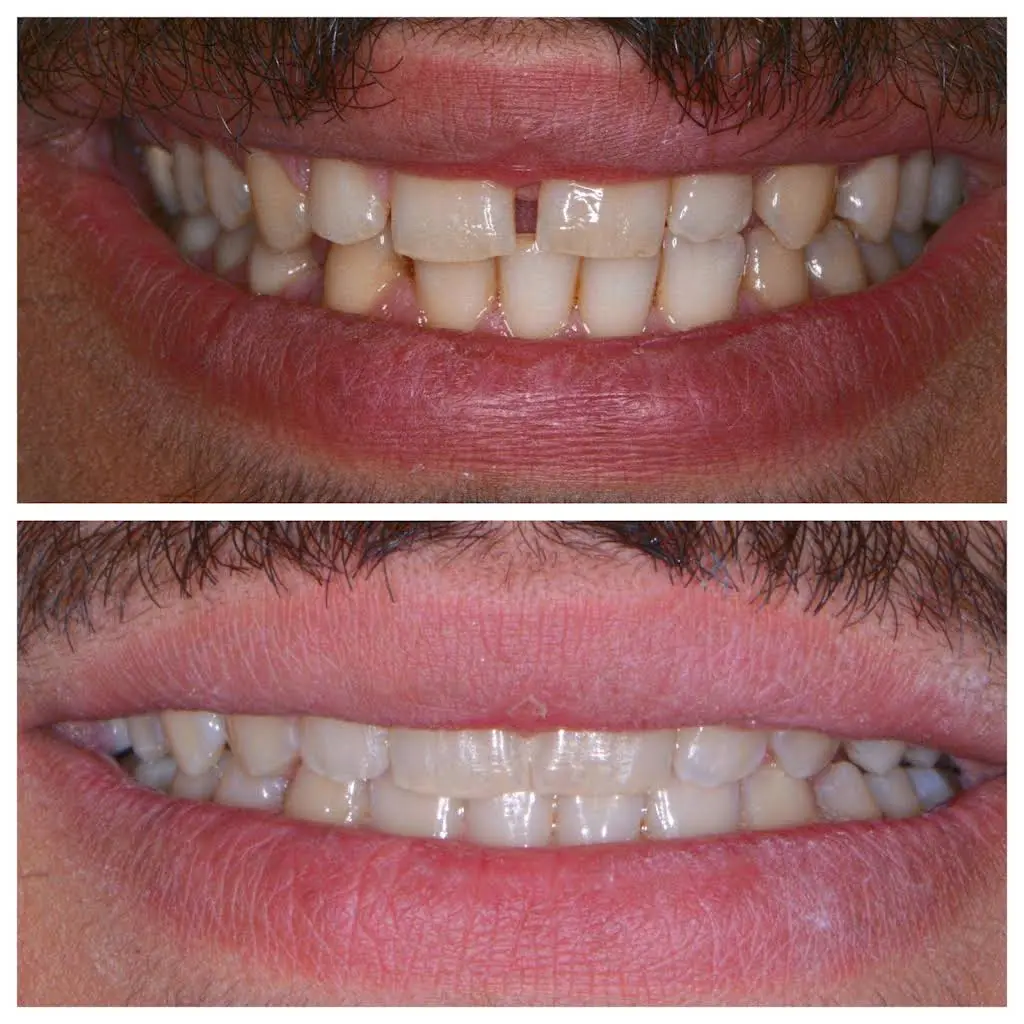Clarkston Dental Care