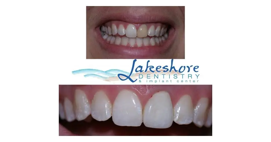 Lakeshore Dentistry & Implant Center