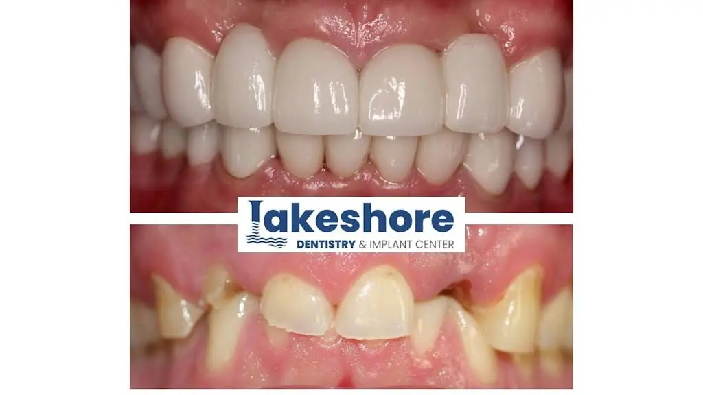 Lakeshore Dentistry & Implant Center