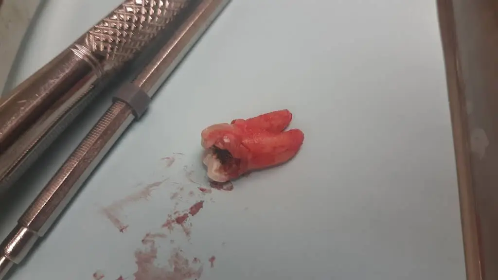 Aspen Dental