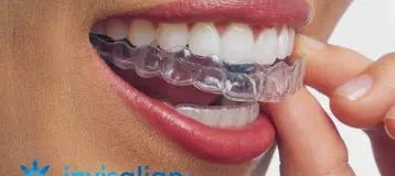 Blue Water Orthodontics