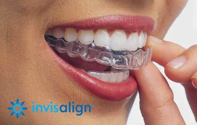 Blue Water Orthodontics