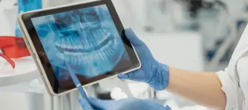 Holland Root Canal Specialists