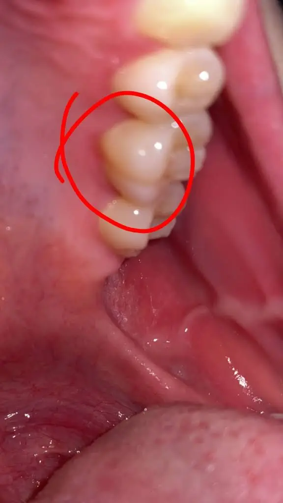 Aspen Dental