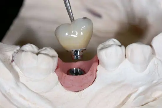 Anchor Family Dentistry