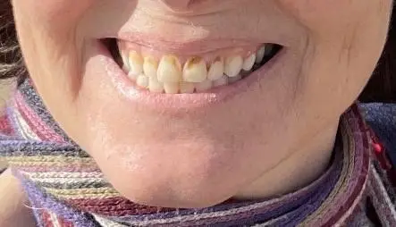 Premier Family Dental