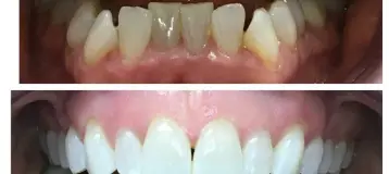 Bailey Dental Group