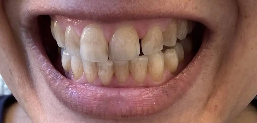 The Dental Center of Granger