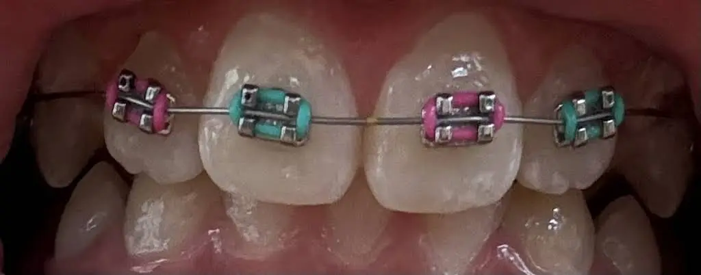 Hinesly Orthodontics
