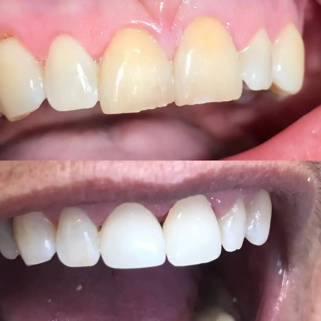 Kapadia Dental Care PLC