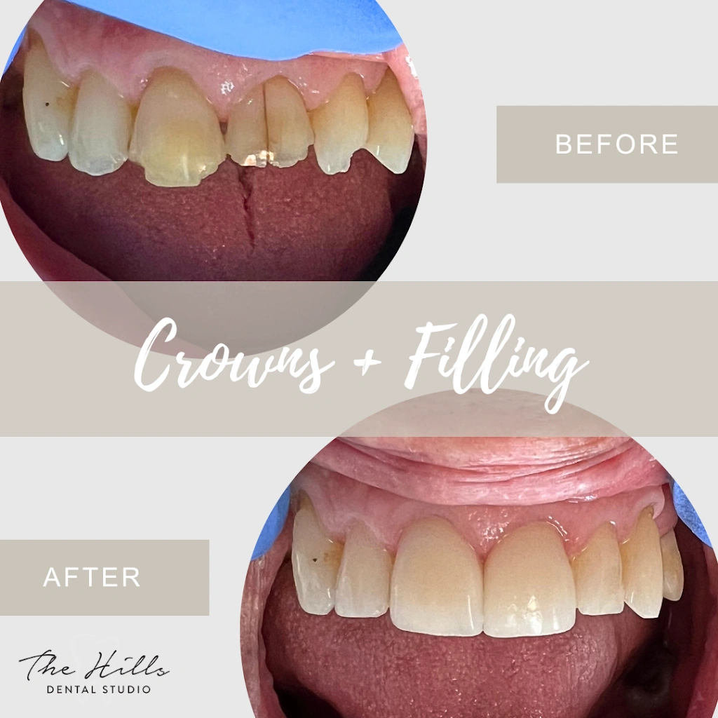 The Hills Dental Studio