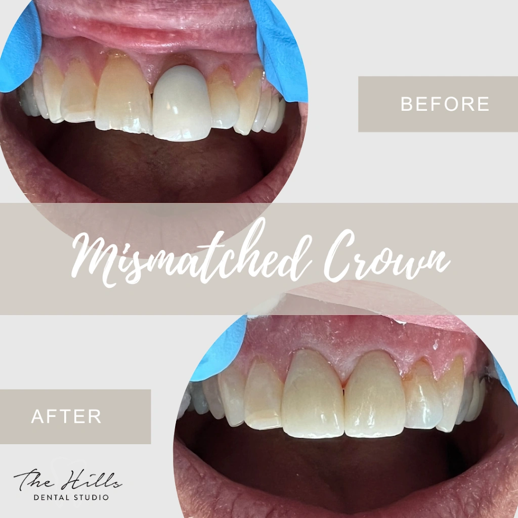 The Hills Dental Studio