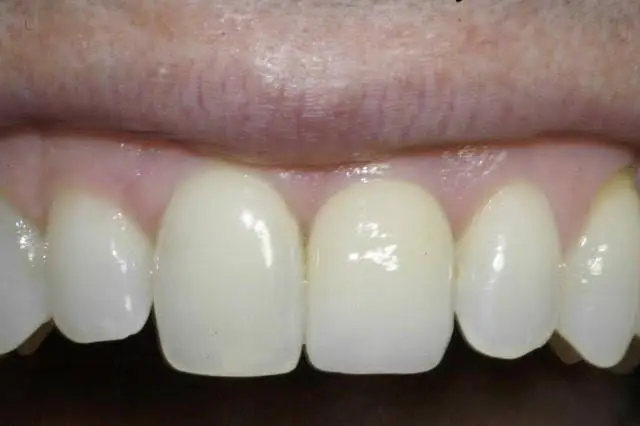 University Dental Associates