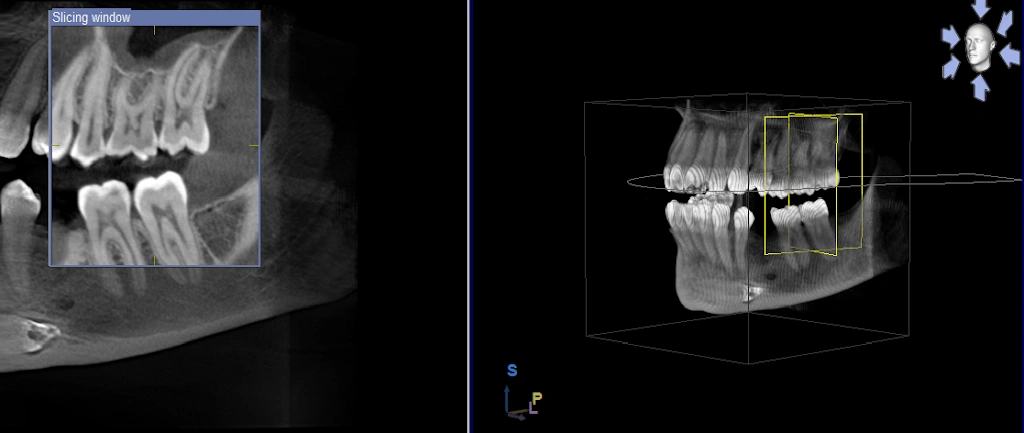 Endodontic Services, Inc.