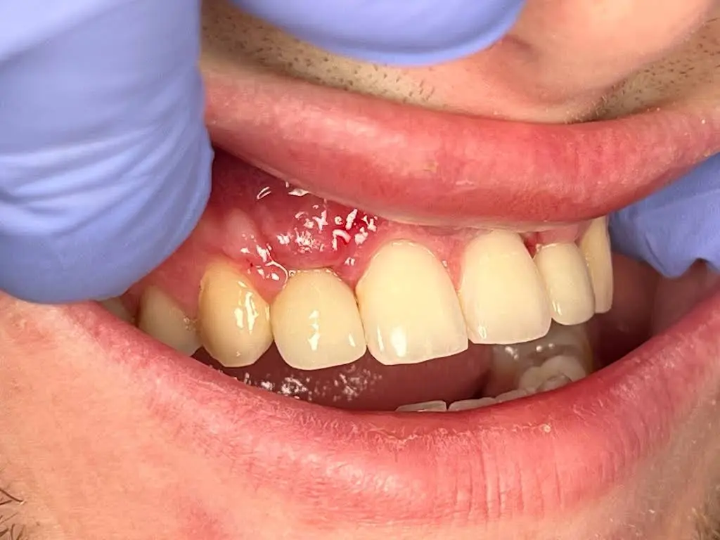 Lyon Dental Implants and Oral Surgery
