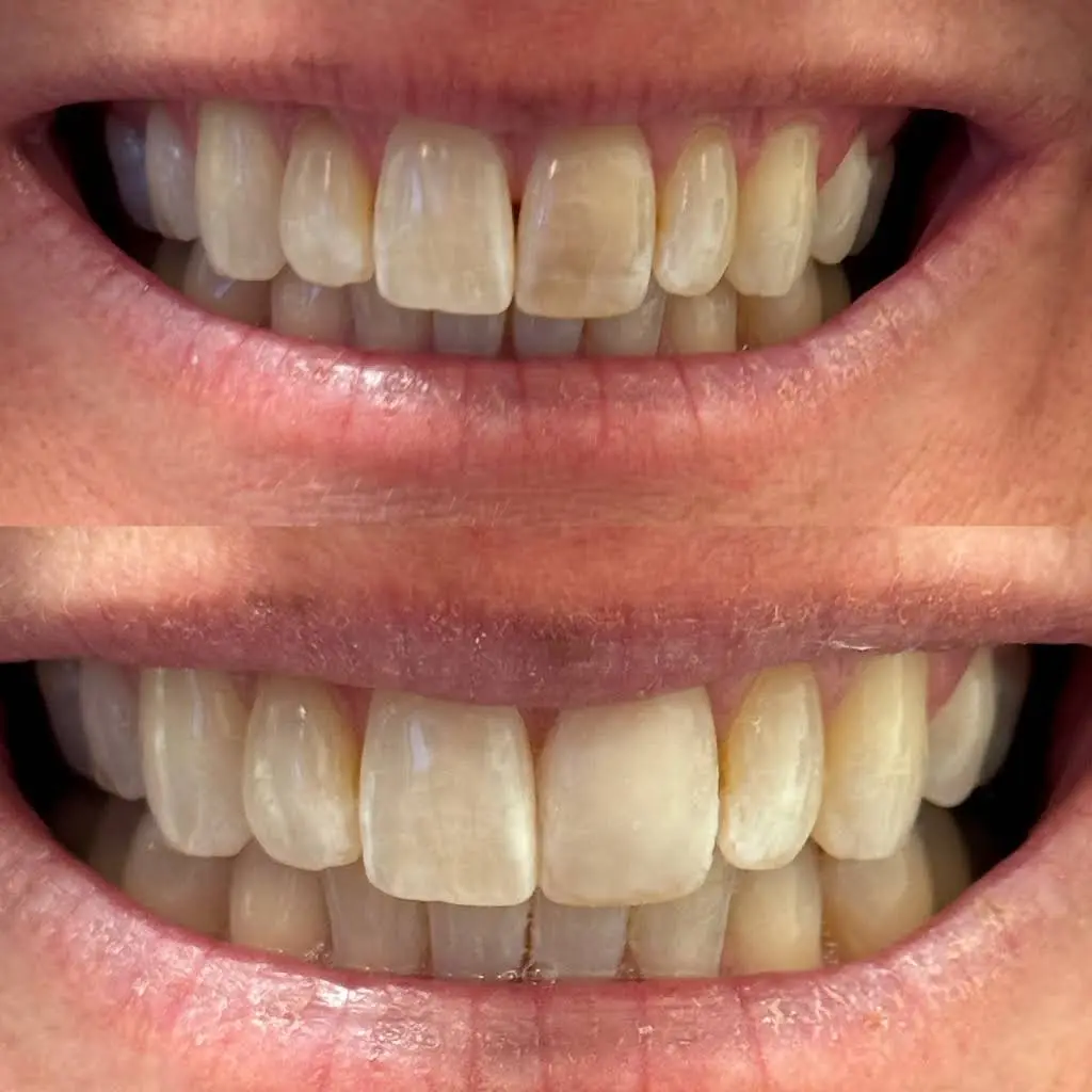 Hoffman Dental Care