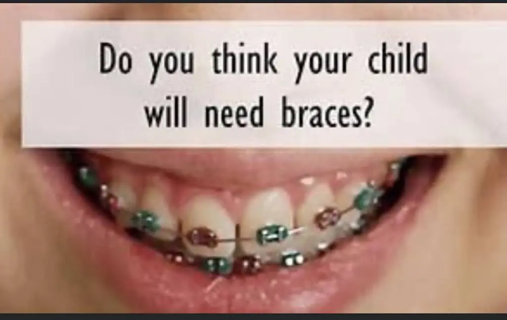 Extra Dental of Shelby Township