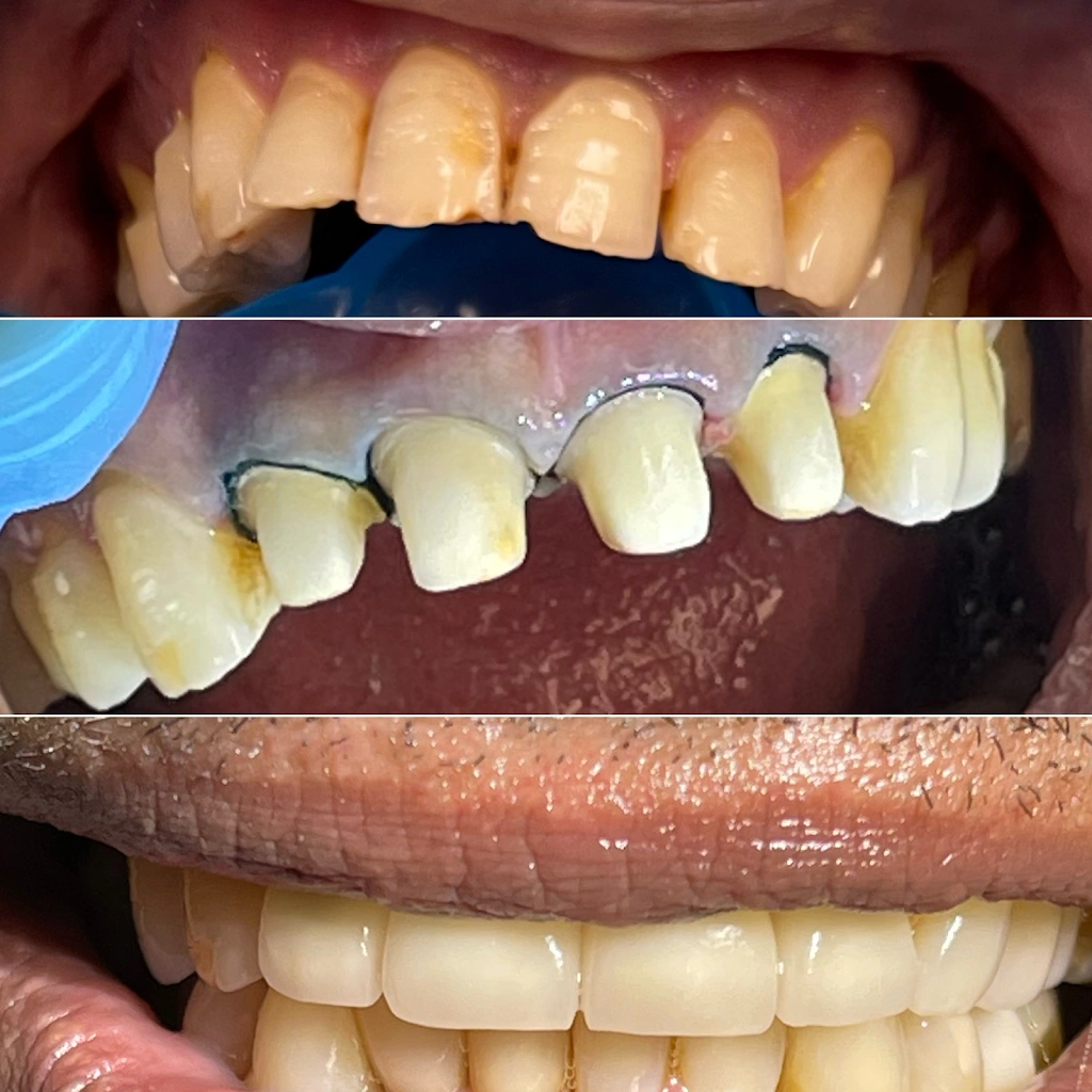 Pristine Dental Care