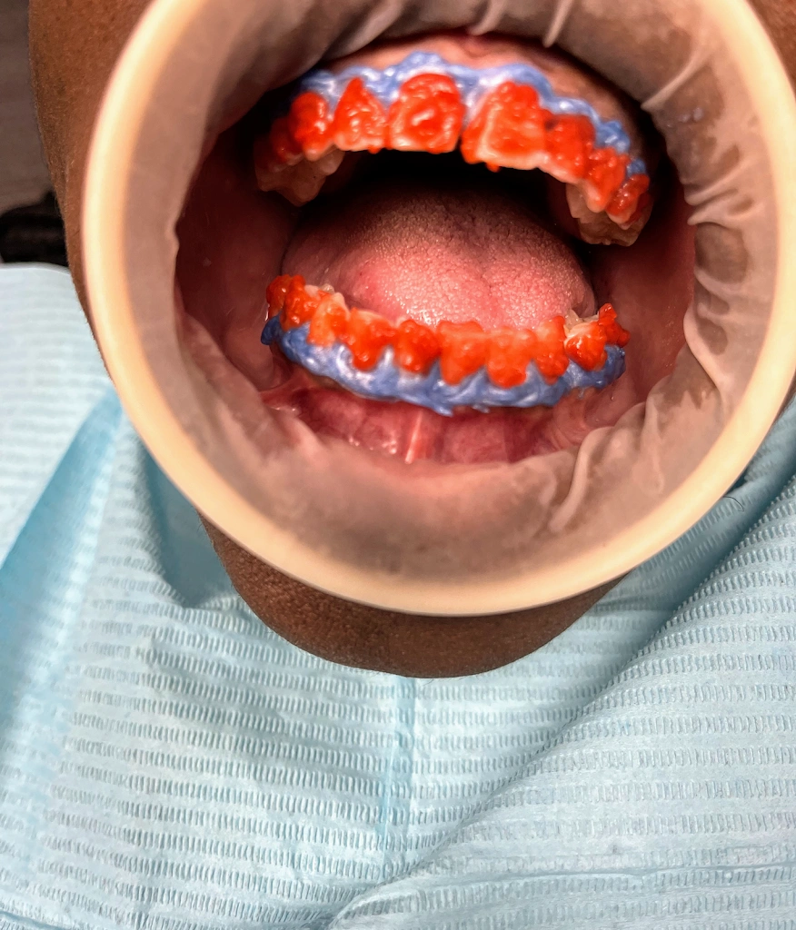 Pristine Dental Care