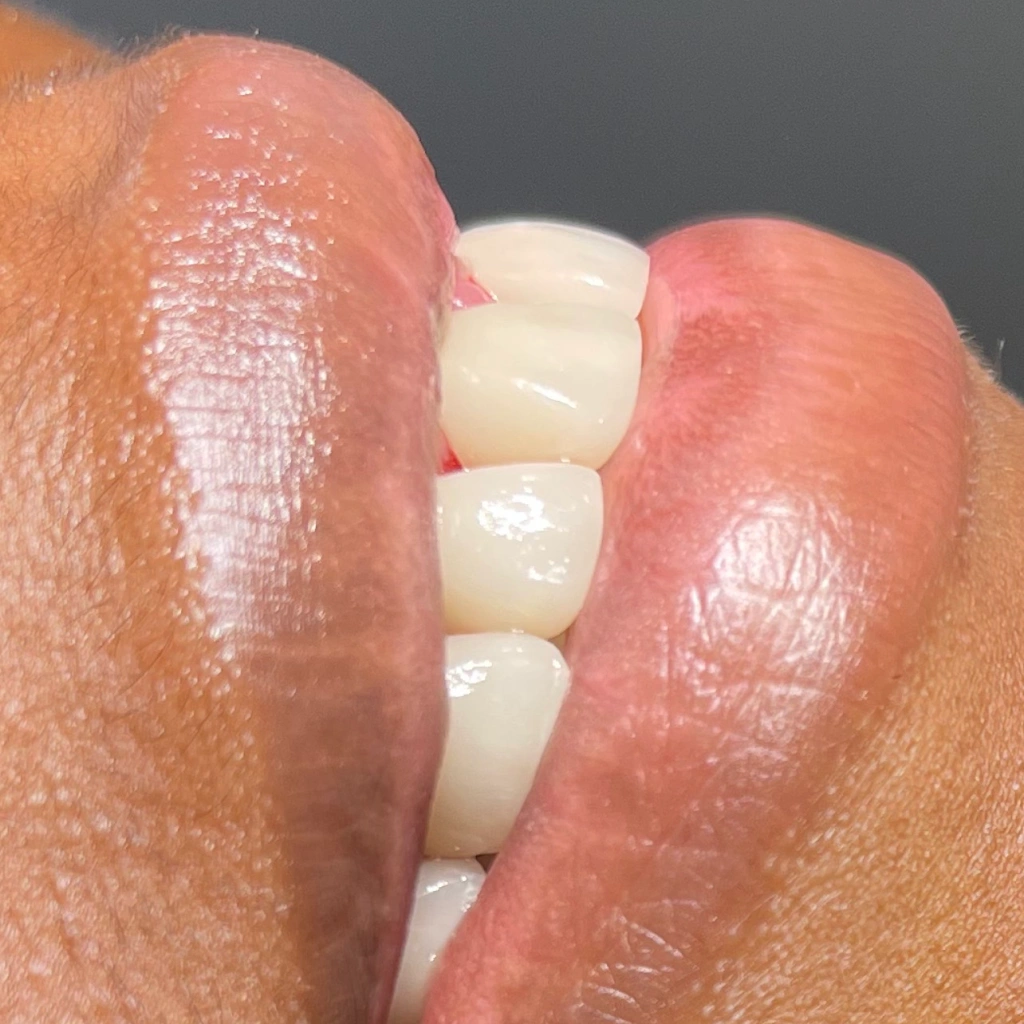 Pristine Dental Care