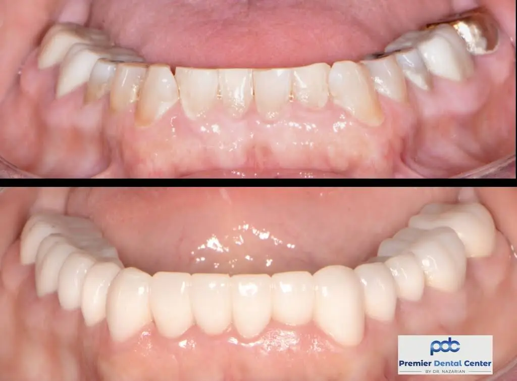 Premier Dental Center: Dr. Ara Nazarian