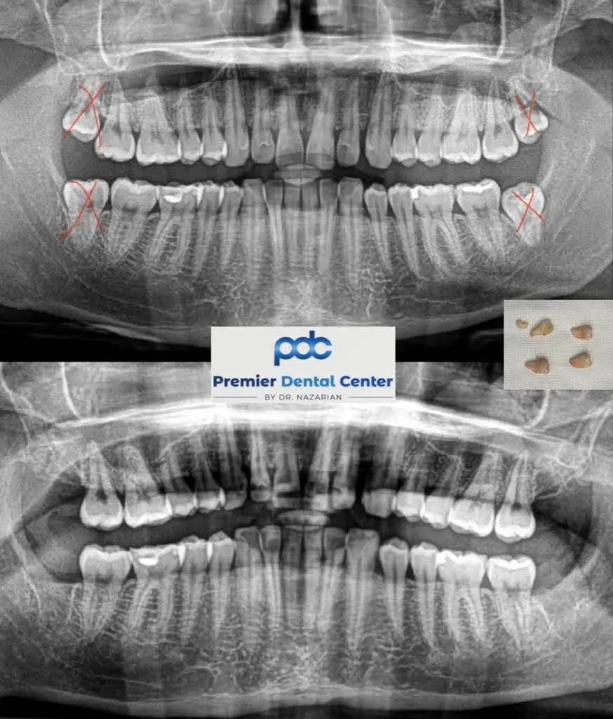 Premier Dental Center: Dr. Ara Nazarian