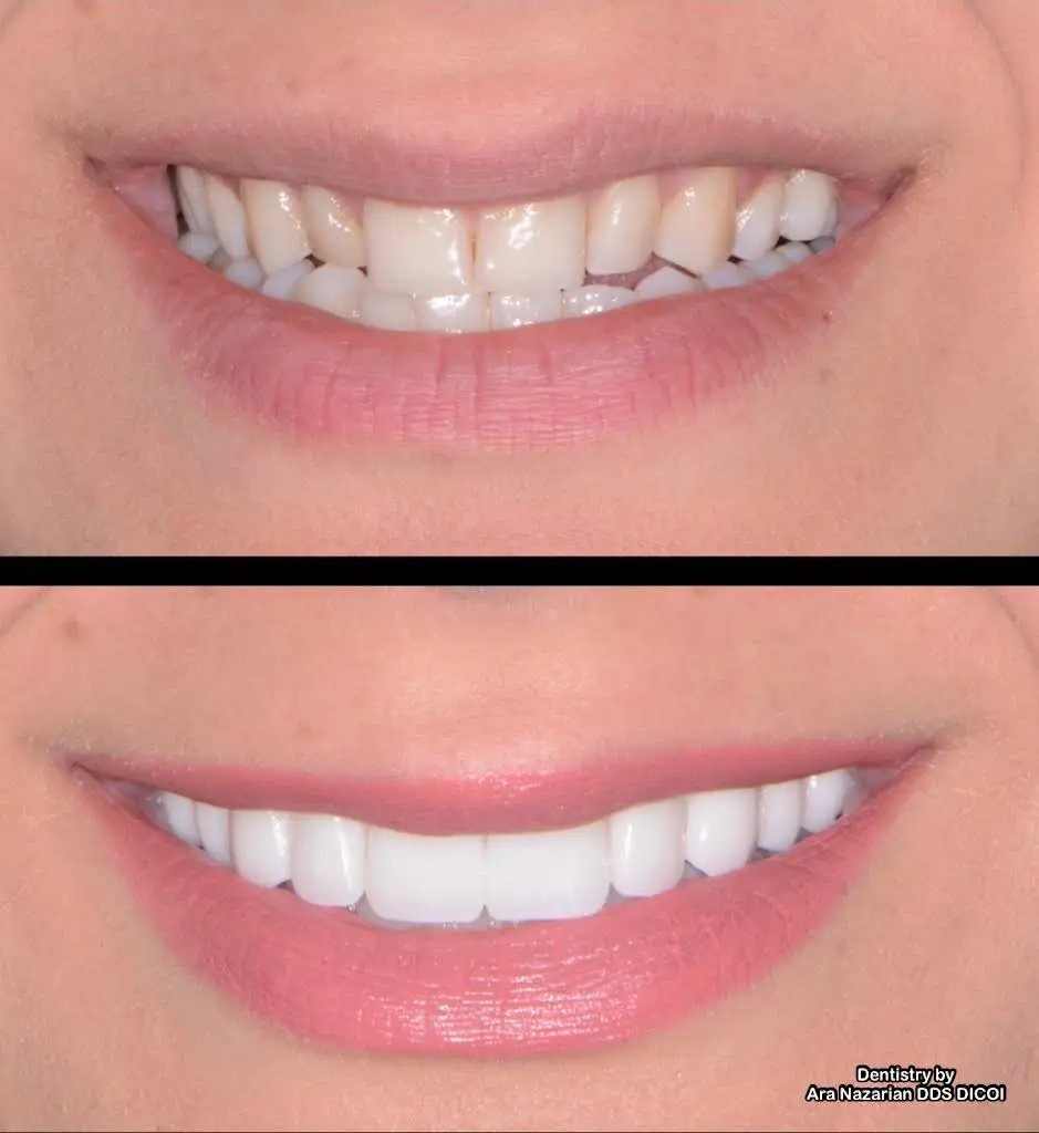 Premier Dental Center: Dr. Ara Nazarian