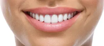 Pure Smiles