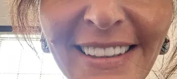 Alpine Dental Center