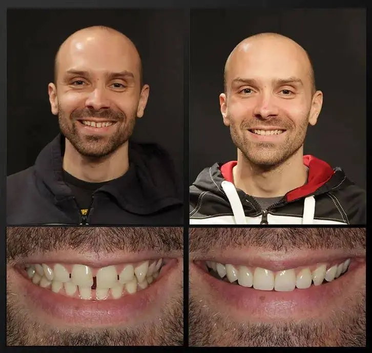 Rochester Advanced Dentistry