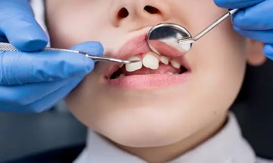 South Bend Emergency Dental