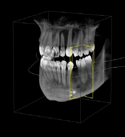 Endodontic Services, Inc.